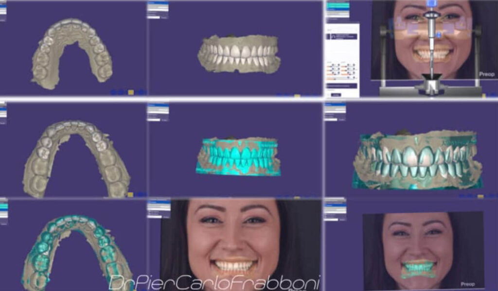 Odontoiatria Digitale 1 Odontoiatria digitale, Immagini dentista