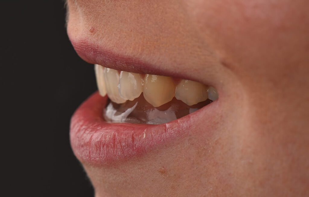 Posturologia e ATM 5 Gnatologia, Gnatologo, Occlusione dentale, Gnatologo Bologna