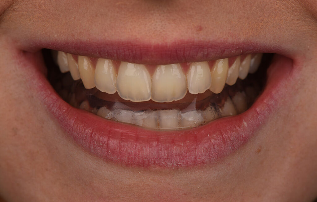 Posturologia e ATM 6 Gnatologia, Gnatologo, Occlusione dentale, Gnatologo Bologna