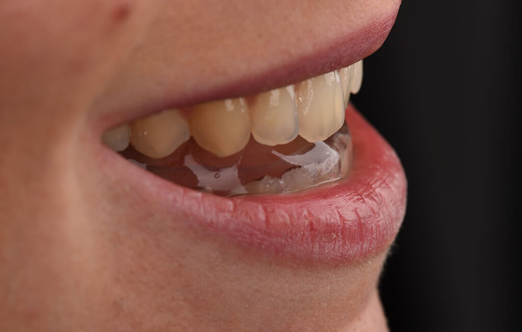 Posturologia e ATM 7 Gnatologia, Gnatologo, Occlusione dentale, Gnatologo Bologna