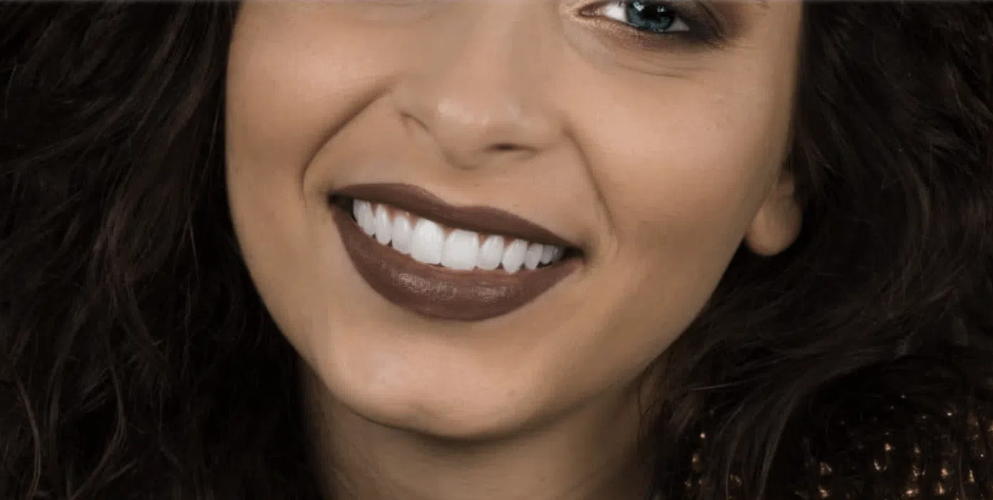 Faccette denti: un buon motivo per sorridere!