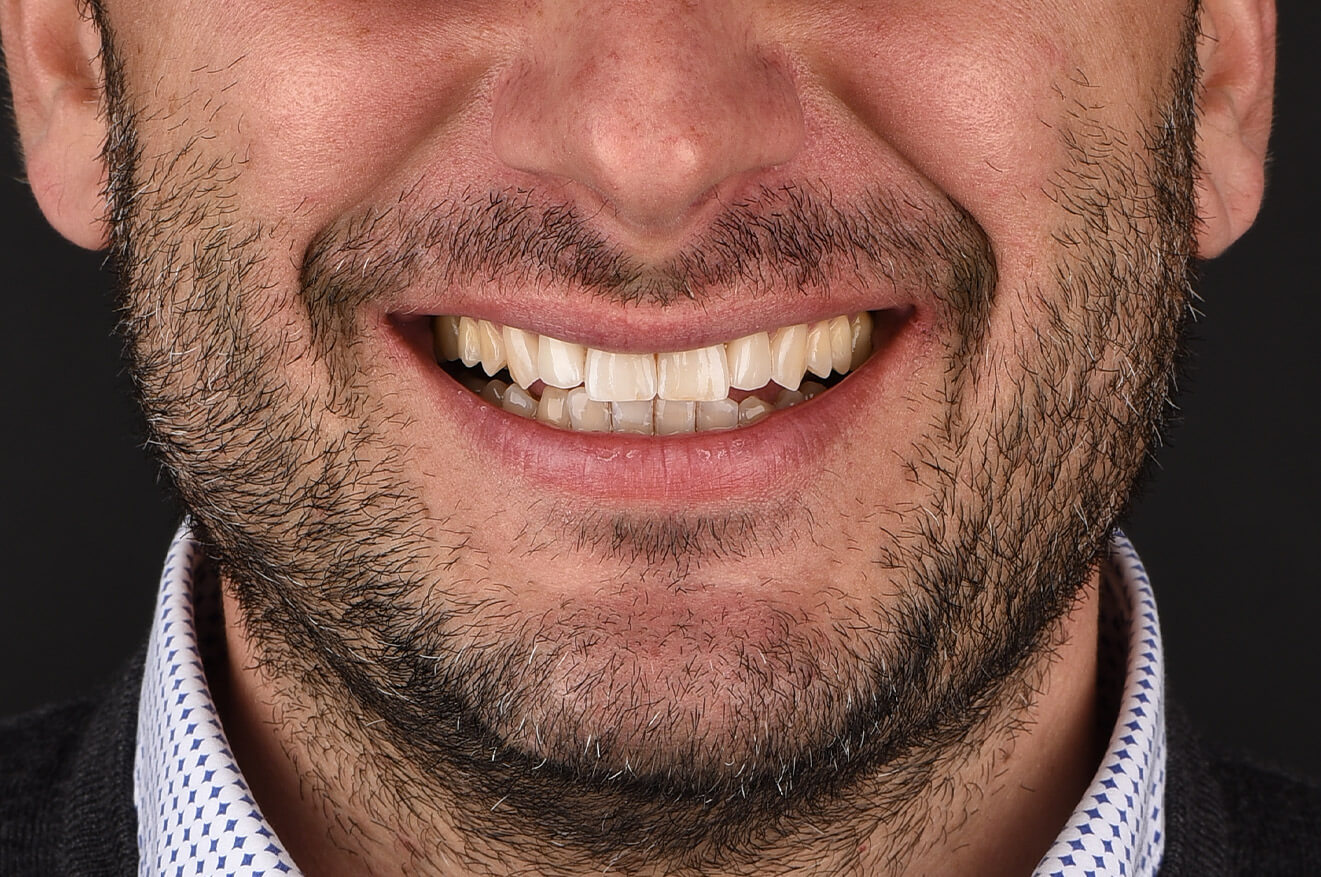Ortodonzia, implantologia e faccette dentali