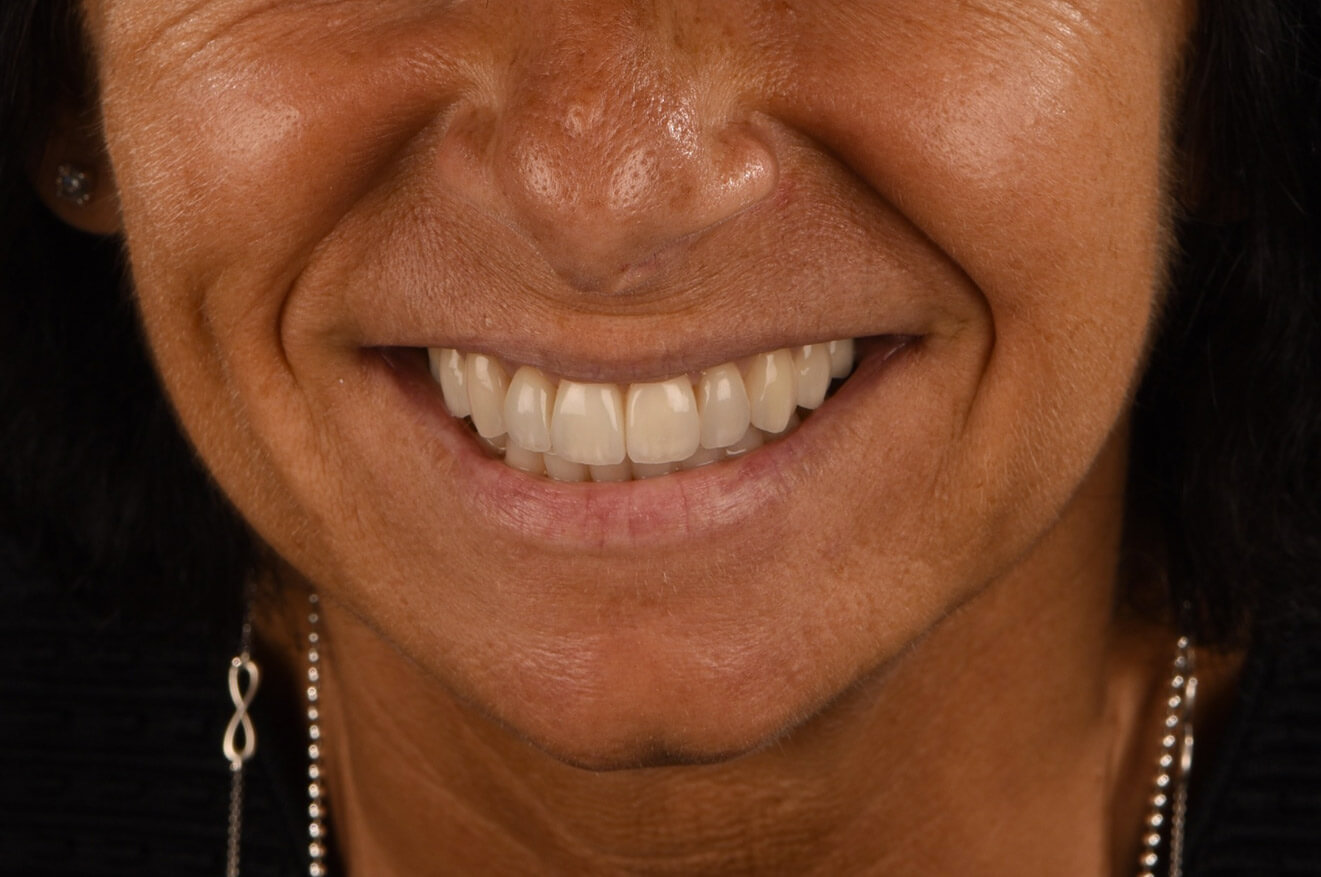Ortodonzia, sbiancamento e faccette dentali