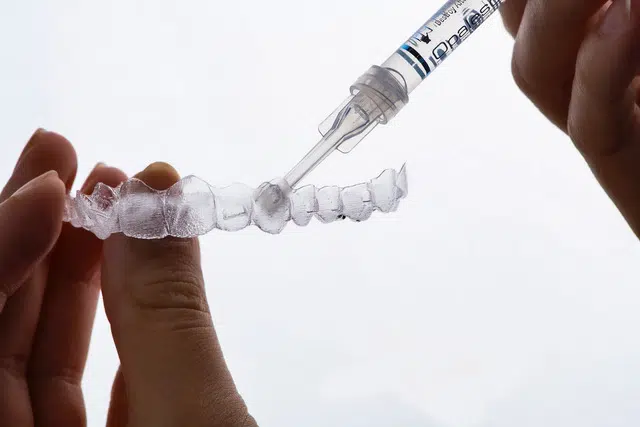Sbiancamento Dentale Quanto dura? Rimozione delle macchie dentali