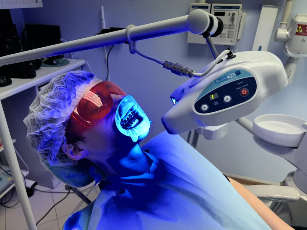 Ci sono situazioni in cui i denti Fanno Male Dopo lo Sbiancamento? Sbiancamento Denti Prima e Dopo/ Il "Glow-Up" Senza Compromessi 2 Ci sono situazioni in cui i denti Fanno Male Dopo lo Sbiancamento? Sbiancamento Denti Prima e Dopo: Il "Glow-Up" Senza Compromessi